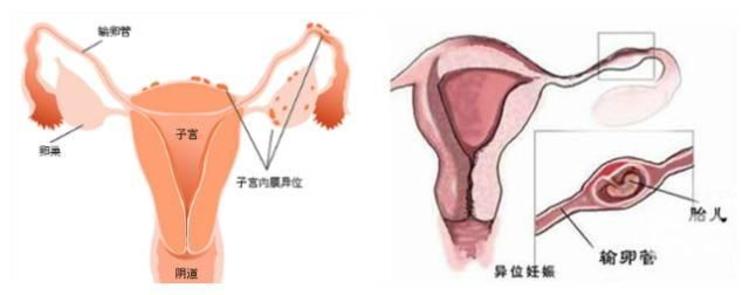 西瓜