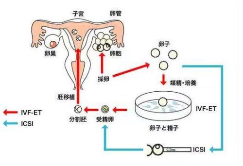 新生儿