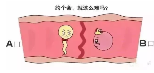 多囊卵巢综合征