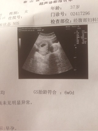瑜伽