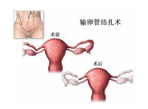 孕反