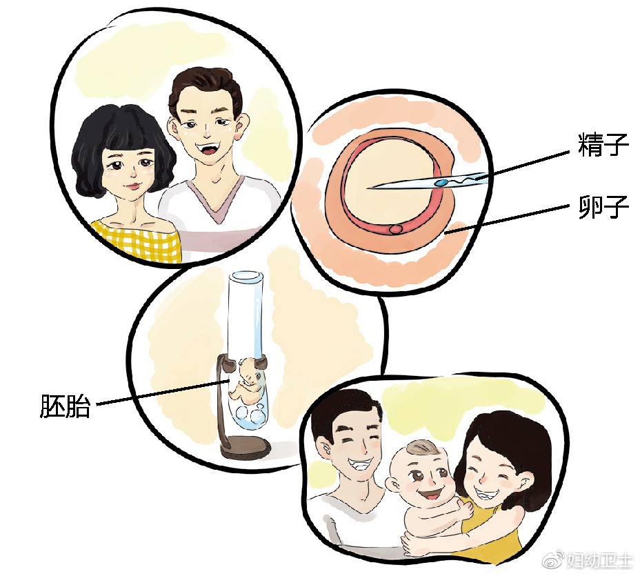 加速