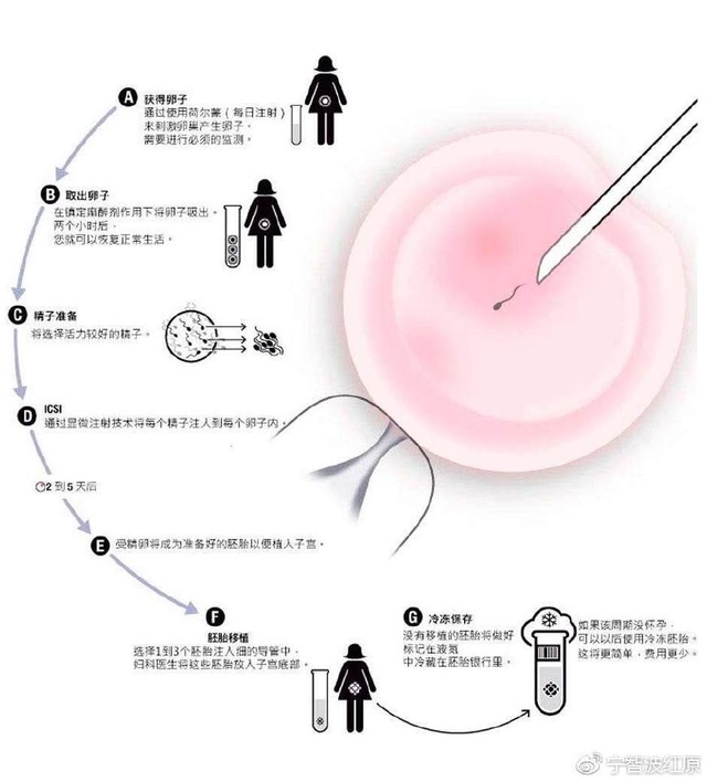 孕期性别鉴定