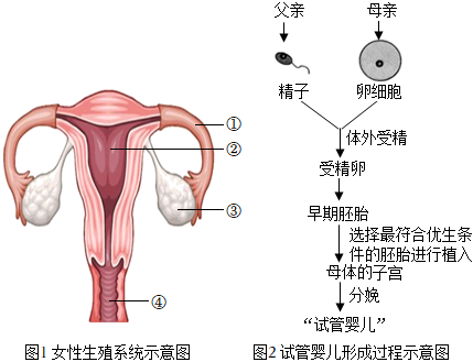 先兆流产