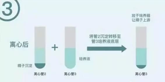 女性不孕不育