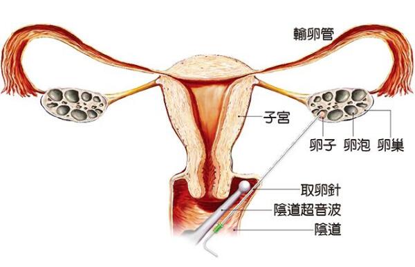 为什么天天做还是没有怀孕