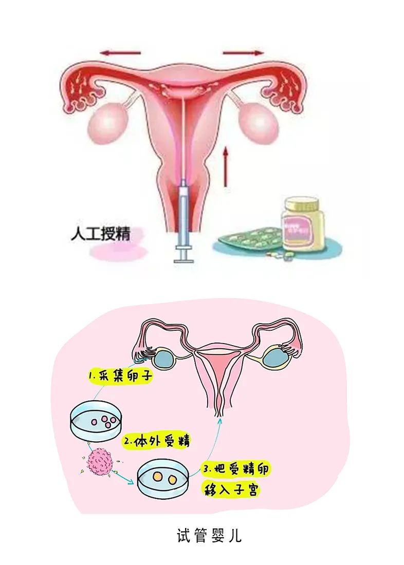 临床诊断早孕人流