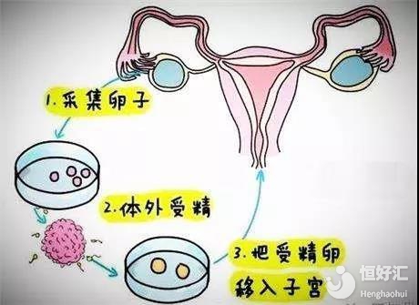 胎位不正