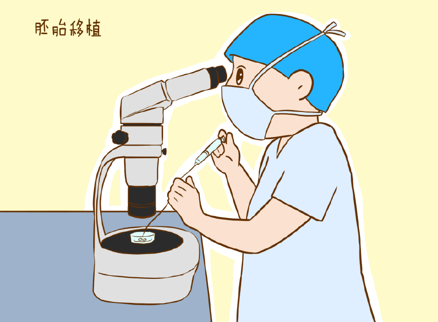 捐卵过程
