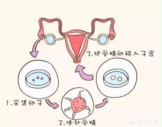 捐卵